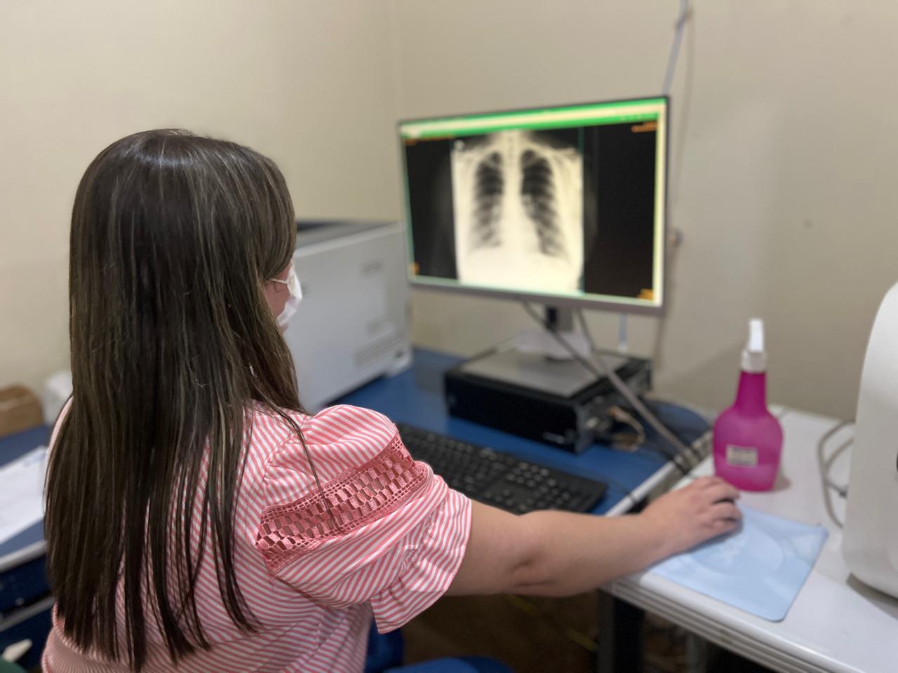 Tuberculose &eacute; uma doen&ccedil;a infecciosa transmitida pelo ar. Foto: HMS/Semsa/Ag&ecirc;ncia Santar&eacute;m.